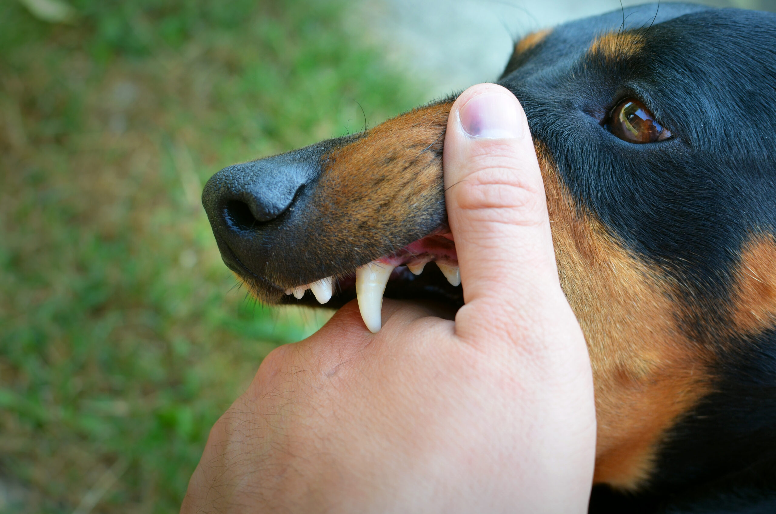 Primer plano extremo de la boca y los afilados dientes caninos de un Doberman Pinscher sobre una mano, ilustrando una mordedura de perro o agresión canina.