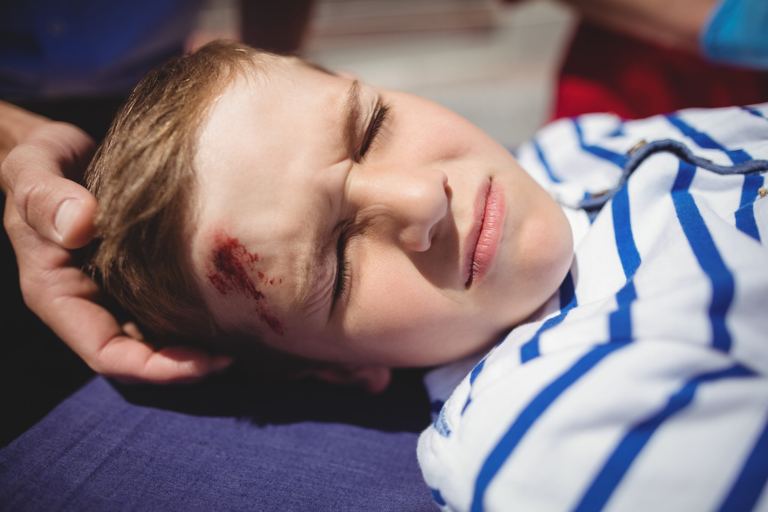 Niño con lesión en la frente y abrasión visible descansando en los brazos de su cuidador, representando atención pediátrica, recuperación de accidentes, primeros auxilios y apoyo médico infantil
